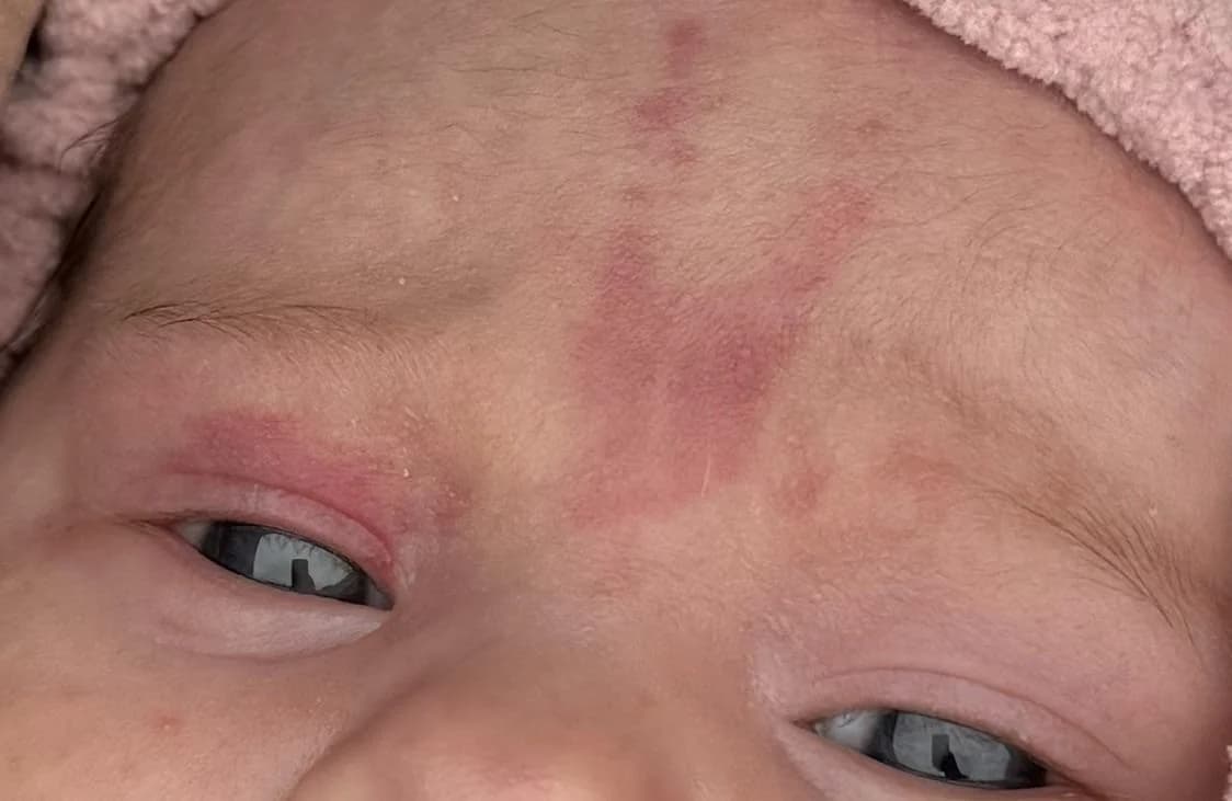 Diez cosas raras que les pasan a los recién nacidos y que son muy comunes.